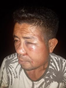 Korban Penganiayaan, Jembris Rumauru Warga Desa Samasuru, Kecamatan Teluk Elpaputih